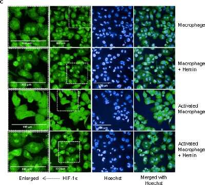 Immunocytochemistry/ Immunofluorescence: HIF-1 alpha Antibody - BSA Free [NB100-134]